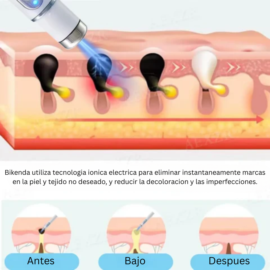Lápiz Láser Bikenda®: Ayuda a mejorar la apariencia de verrugas y marcas en casa
