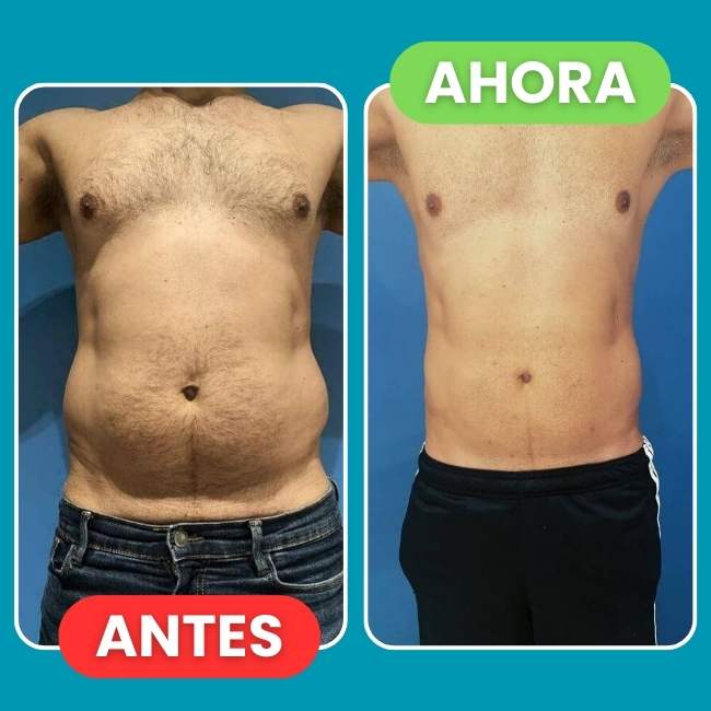 Encabezado